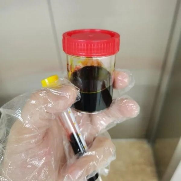 急性肝衰竭！兩兄弟誤吃這種菌 專家提醒